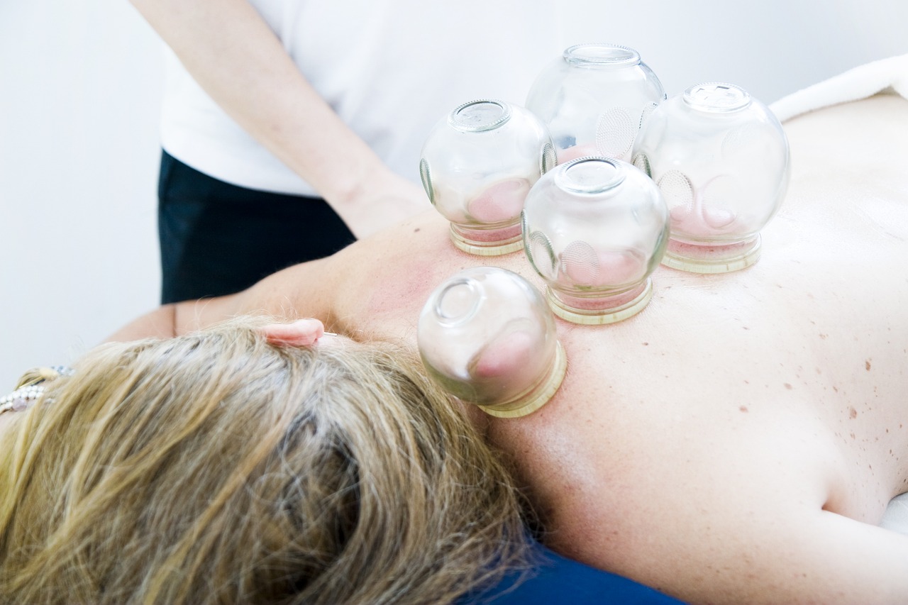 Cuppingmassage